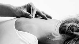 dry_needling